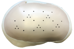 MedCAD-AccuShape-Cranial-Implant-Brochure-10